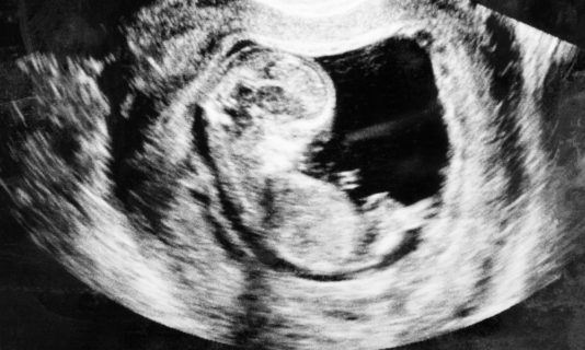 Is an unborn child part of the mother’s body, or a separate human being?